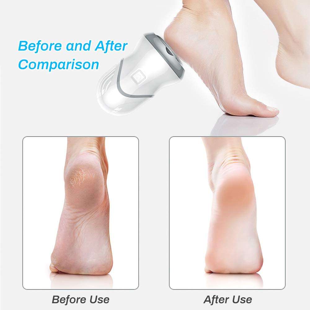 Rechargeable Foot Files Clean Tools for Hard Cracked Skin Electric Foot Grinder Vacuum Callus Remover Foot Pedicure Tools