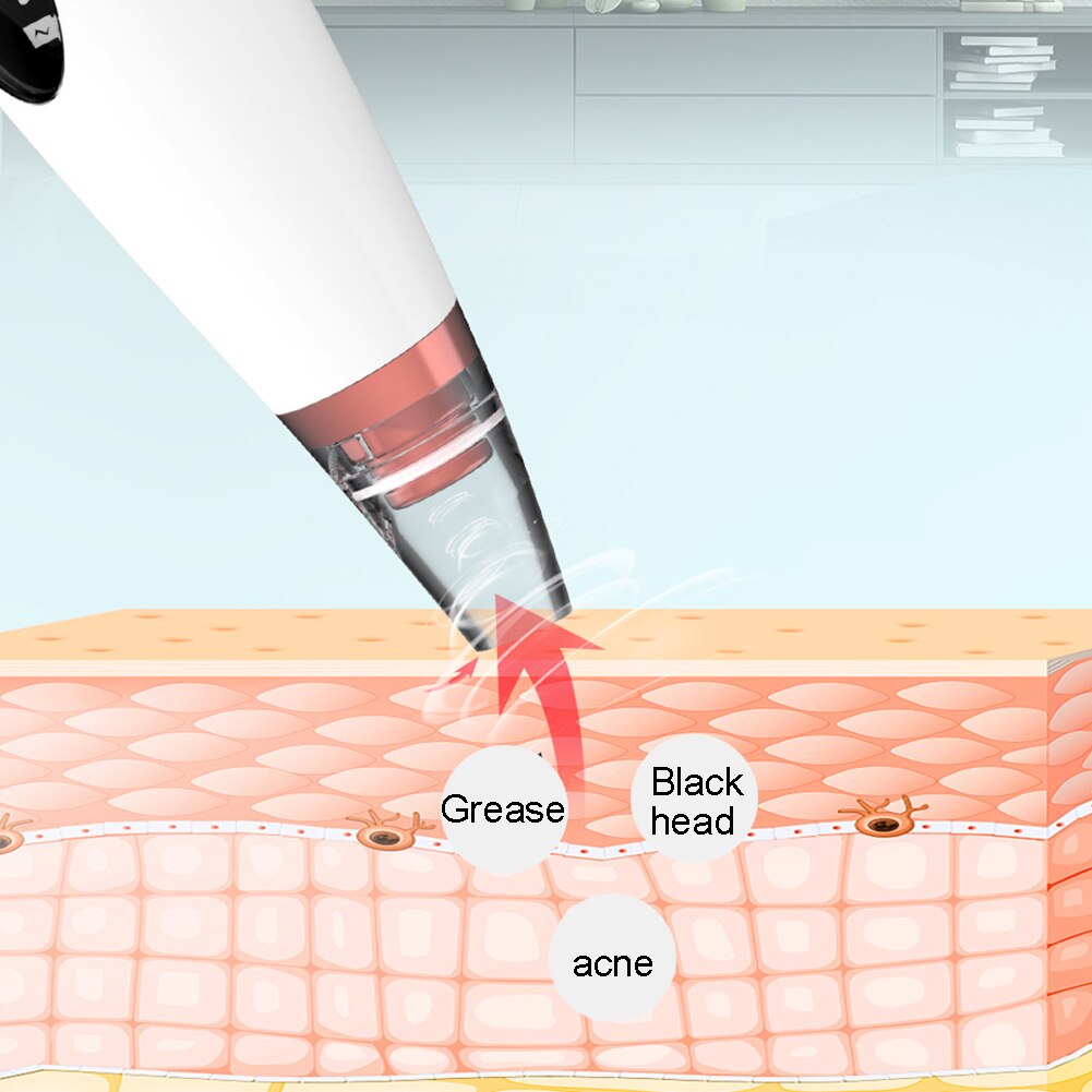 6 in 1 Electric Blackhead Remover Vacuum Acne Extractor Facial Pore Cleanser The rechargeable design is convenient for repeated