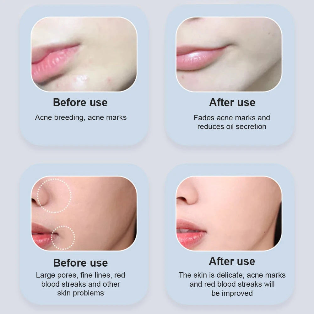 Led Therapy Mask 7 Colors Light Therapy Facial Mask Skin Rejuvenation Electroporation Beauty Instrument Photon Reduce Wrinkle