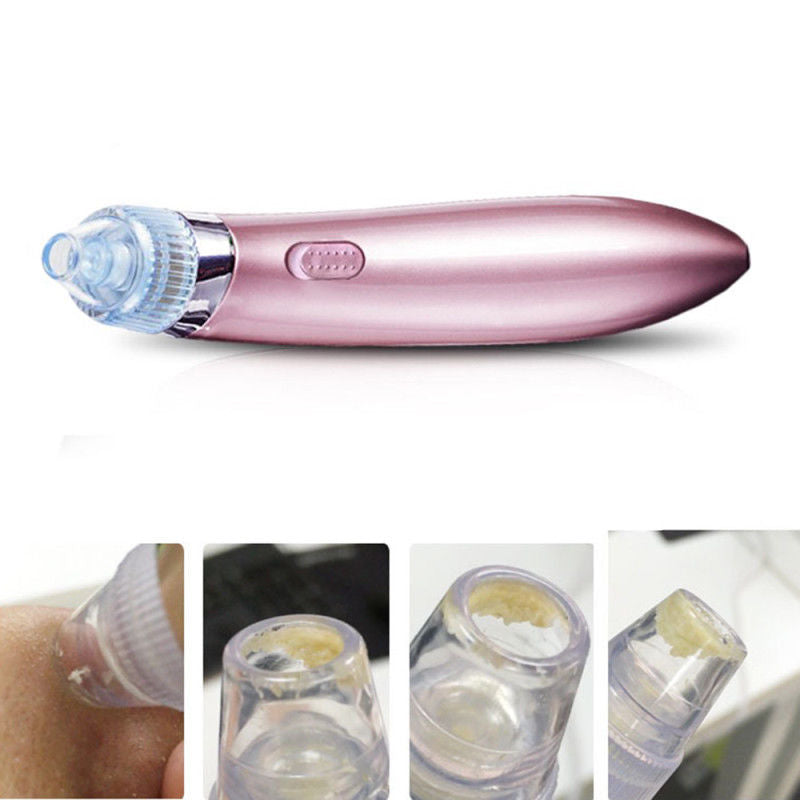 Facial Pore Blackhead Cleaner Remover Vacuum Comedo Suction Diamond Dermabrasion