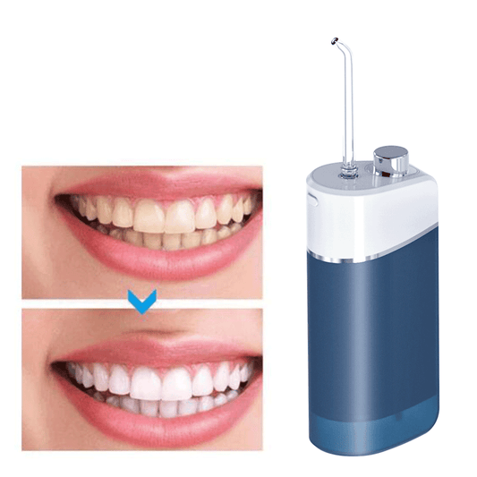 Pulling Water Flosser Household Mini Smart Oral Cleaning Tooth Washing Machine Electric Portable Tooth Washing Machine