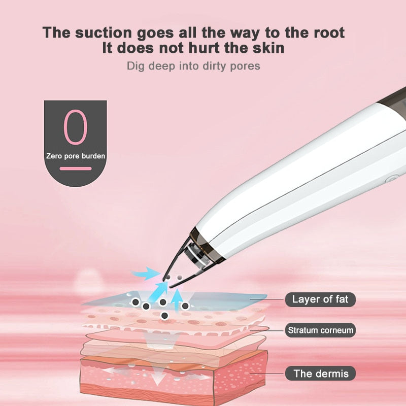 Electric Blackhead Remover Facial Nose Cleansing Pore Acne Cleanser Pore Cleansing Blackhead Instrument