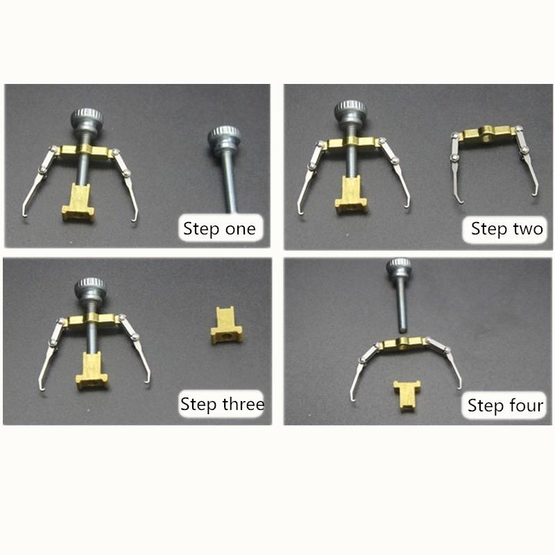 ingrown toenails pedicure foot nail care tools file for feet orthotic acronyx ingrowing nail onyxis