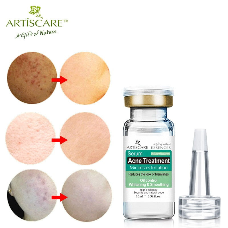 ARTISARE Acne Original Liquid essence