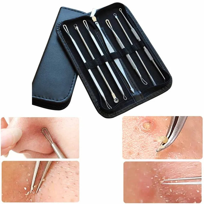 7pcs/lot Pimple Blemish Comedone Acne Needle Extractor Remover Tools Set