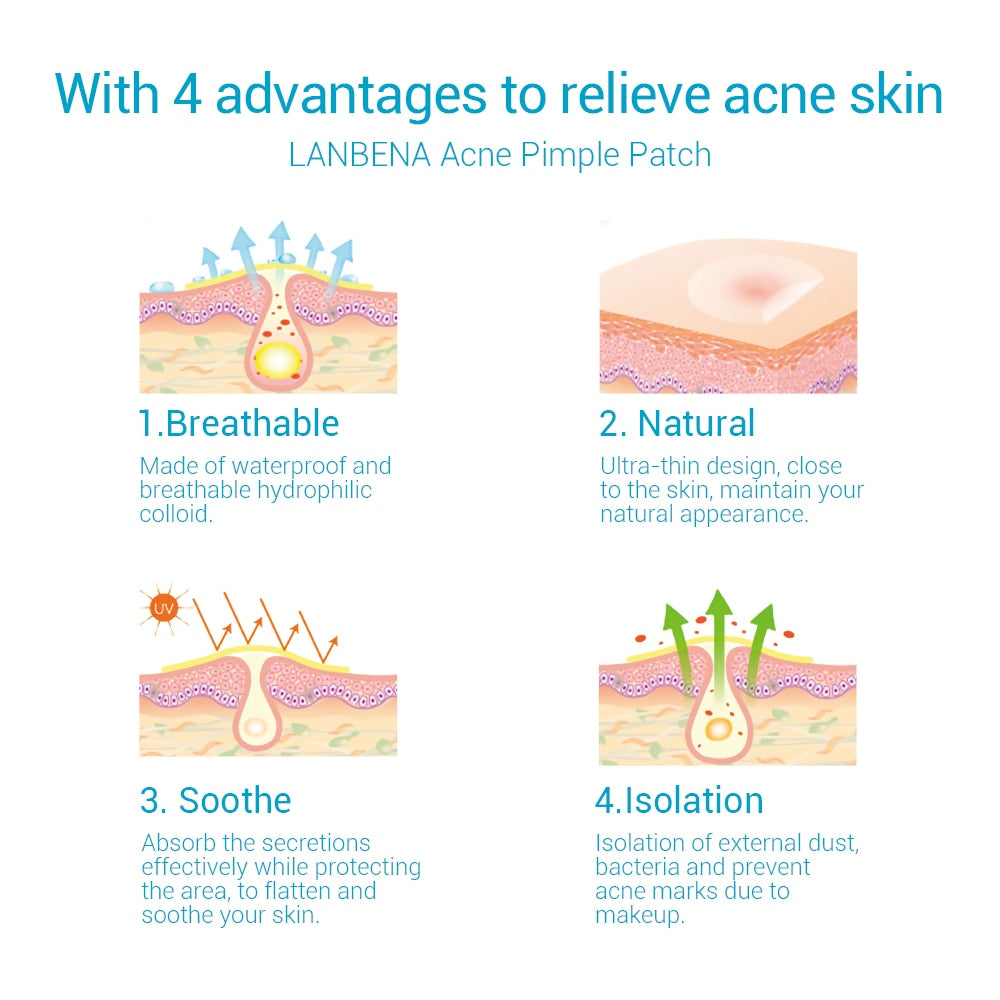 LANBENA Acne Pimple Patch  Invisible Acne Stickers Blemish Treatment Acne Master Pimple Remover Beauty Tool Skin Care
