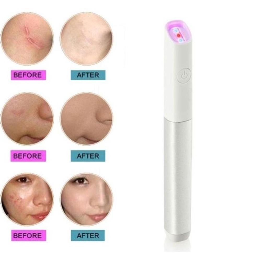 Spider Vein Eraser Anti-varicose Veins Removal Pen Blue/Red Light Machine for Anti-Inflammation Acne Scar Removal Wrinkle Removal Treatment Skin Tightening