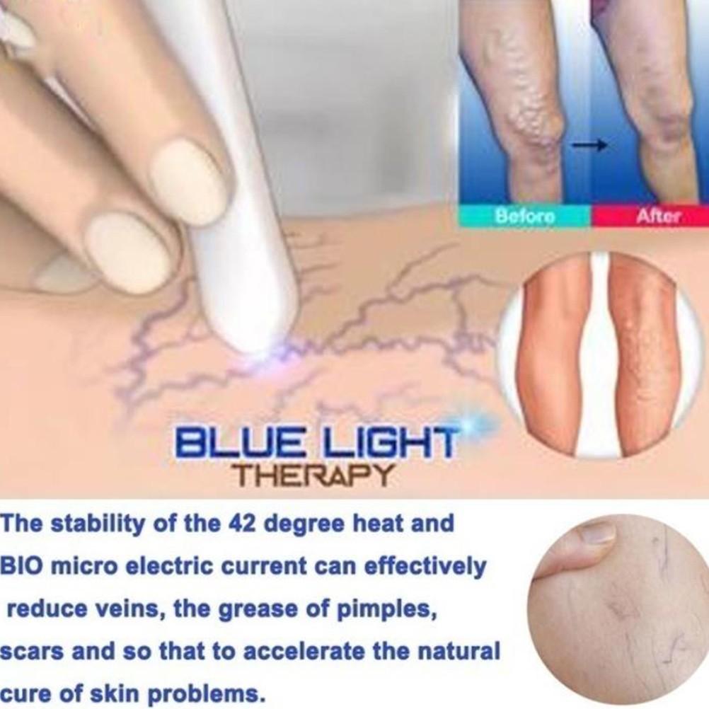 Spider Vein Eraser Anti-varicose Veins Removal Pen Blue/Red Light Machine for Anti-Inflammation Acne Scar Removal Wrinkle Removal Treatment Skin Tightening