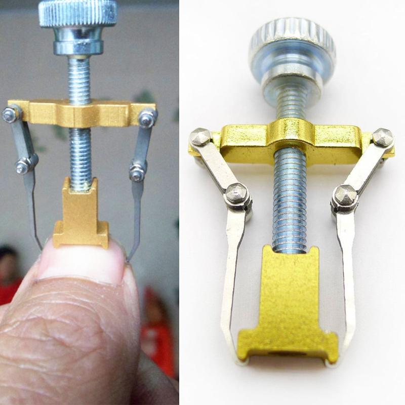 ingrown toenails pedicure foot nail care tools file for feet orthotic acronyx ingrowing nail onyxis