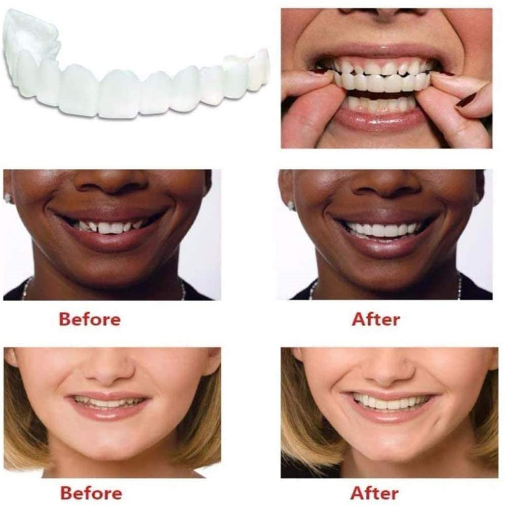Upper Teeth And Lower Teeth Simulation Braces Non-Porous Braces Whitening Sleeves Second-Generation Silicone Simulation Teeth Dentures
