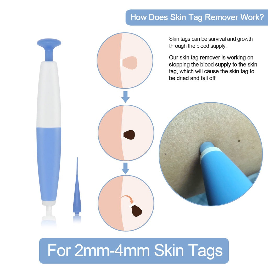 Skin Tag Removal Acne Remover Wart Remover Skin Tag Remover Skin Tag Remover