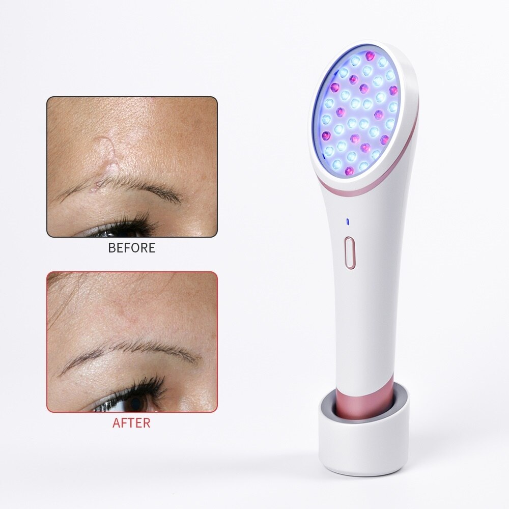 LED Photon Skin Rejuvenation Light Acne Light Therapy Red Blue Light Treatment Device Soft Scar Wrinkle Removal Cleaning Tools