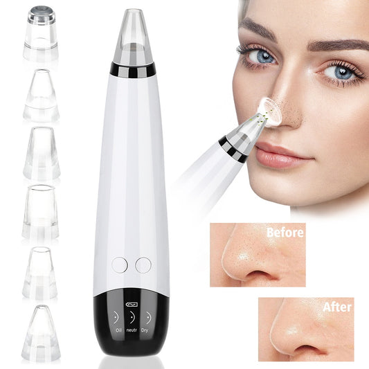 Electric Blackhead Remover Facial Nose Cleansing Pore Acne Cleanser Pore Cleansing Blackhead Instrument