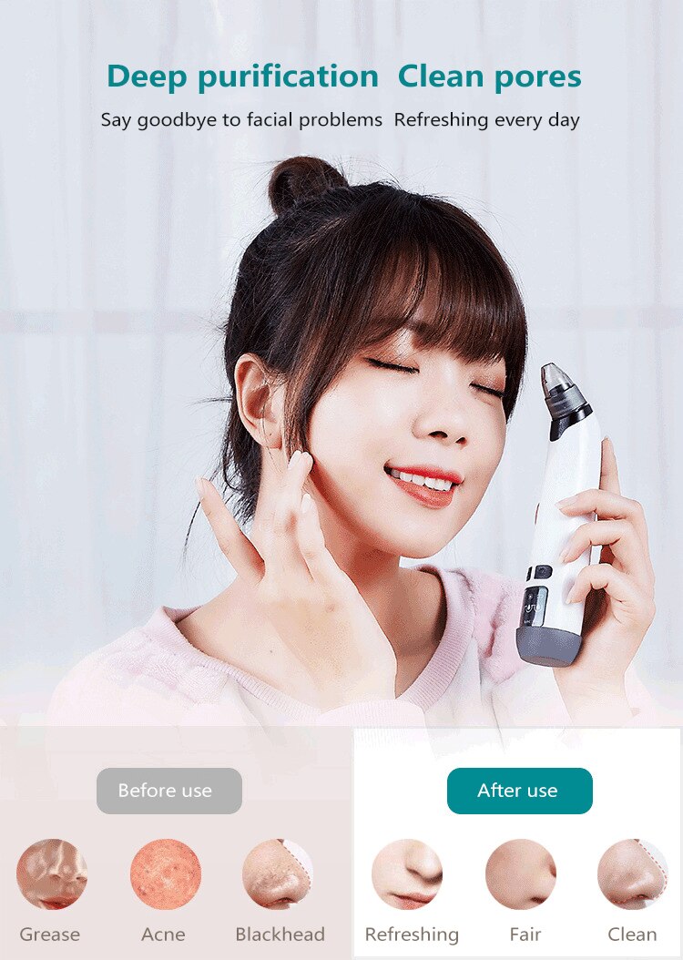 Upgraded Vacuum Absorption Blackhead Remover Pore Facial Cleaner Devices 3 Levels Adjustable Electric Acne Comedone Extractor